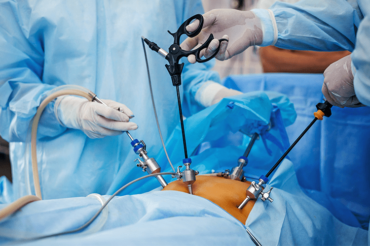 laparoscopic-gi-surgery-in-hyderabad